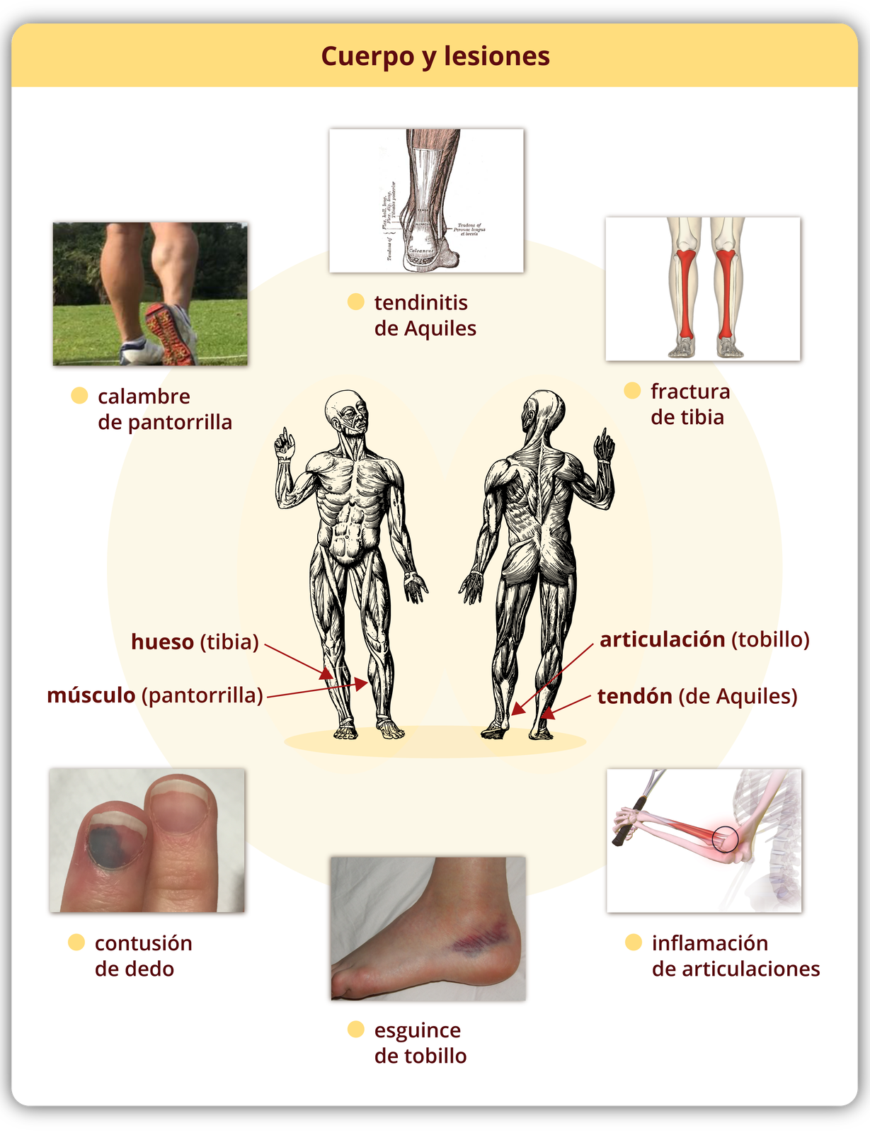 Tytuł grafiki: Cuerpo y lesiones. Poniżej, obrazki z podpisami. Na środku model mięśniowy człowieka ze strzałkami z podpisami odchodzącymi od niektórych części. Piszczel - hueso (tibia). Łydka - muslo (pantorrilla). Staw skokowy - articulación (tobillo). Ścięgno Achillesa - tendón (Aquiles). Zdjęcie łydek osoby w sportowych butach - calambre de pantorrilla. Schematyczna grafika ścięgna Achillesa - tendinitis de Aquiles. Schematyczna grafika z zaznaczonymi piszczelami - fractura de tibia. Zdjęcie dwóch palców przy czym jeden jest siny - contusión de dedo. Zdjęcie stopy z siniakiem pod kostką - esguince de tobillo. Grafika schematyczna z zaznaczonym na czerwono łokciem - inflamación de articulaciones. 