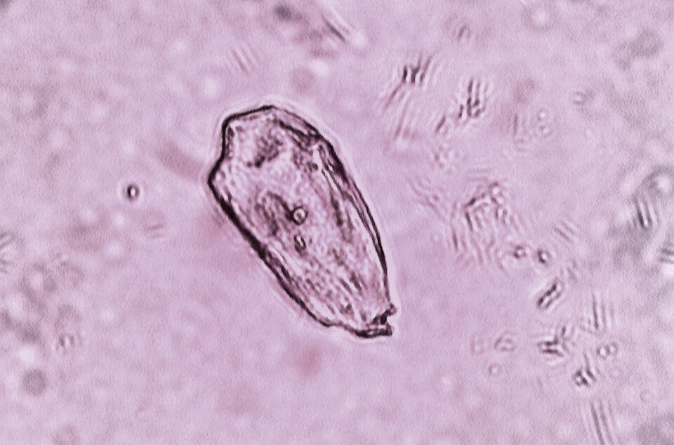 Ilustracja przedstawia zdjęcie mikroskopowe. Przedstawia element o kształcie zbliżonym do owalu. Ma nieco nierówne brzegi. 