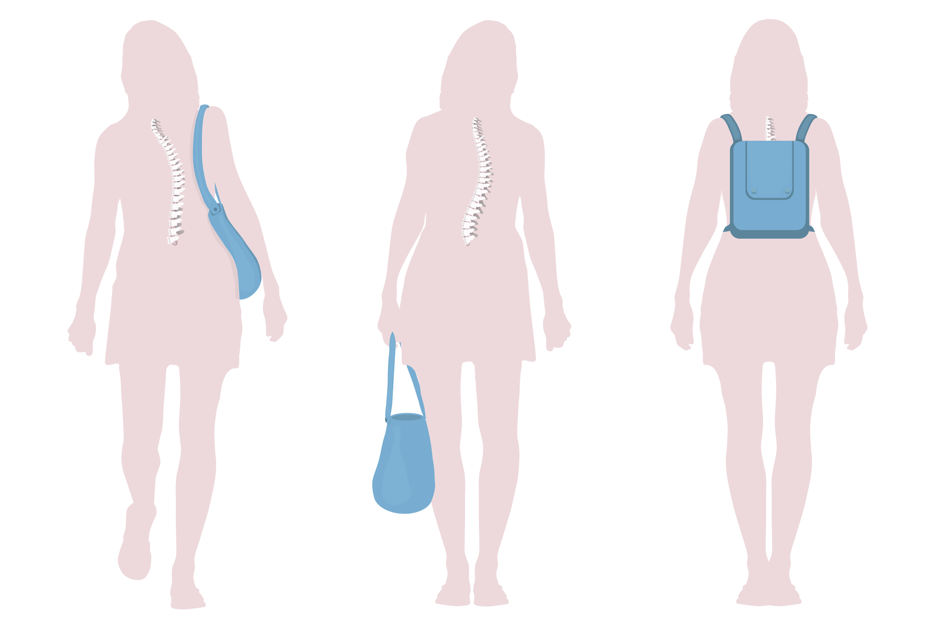 Ilustracja przedstawia 3 liliowe sylwetki kobiety od tyłu. W każdej wrysowano biały kręgosłup. Kobieta z lewej niesie niebieską torbę na prawym ramieniu. Kręgosłup jest mocno bocznie wygięty, ciało pochylone w lewo. Kobieta w środku niesie niebieską torbę w lewej ręce. Kręgosłup bocznie wygięty, lewe biodro wysunięte. Kobieta prawej na niebieski plecak. Kręgosłup prosty, ciało ma prawidłową postawę.