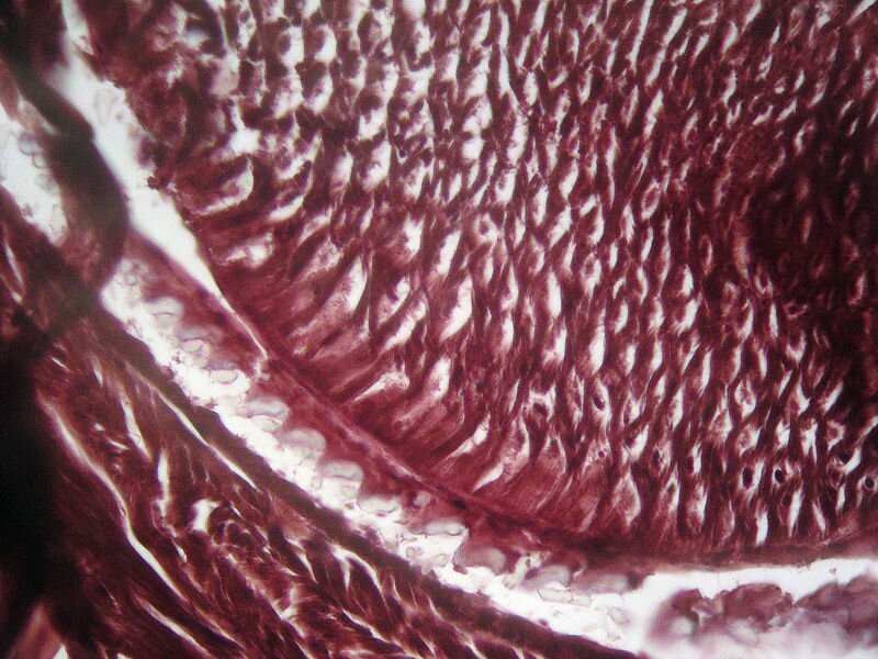 Zdjęcie przedstawia fragment tarki ślimaka Deroceras laeve. Jest to chitynowy fałd pokryty poprzecznymi rzędami zębów. Na fotografii przedstawione są jako nieregularne, białe nierówności na czerwonym tle. 