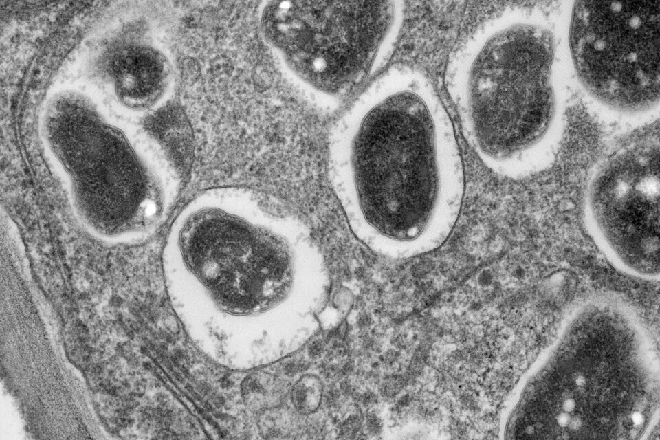Zdjęcie przedstawia bakterie znajdujące się w guzkach korzenia soi w przybliżeniu mikroskopowym. Mają one okrągłą formę, w ich budowie możemy wyróżnić duże, ciemne organellum zajmujące znaczną część ich wnętrza. 