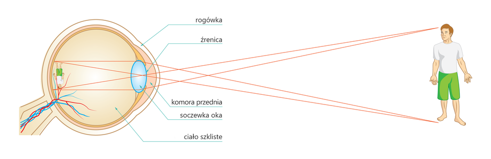 Grafika przedstawia powstawanie obrazu obiektu na siatkówce. Po lewej stronie znajduje się schemat budowy oka, natomiast po prawej znajduje się rysunek mężczyzny. Na schemacie zaznaczono rogówkę, komorę przednią, soczewkę oka, źrenice oraz ciało szkliste. Dwie linie zostały poprowadzone od stóp człowieka do górnej części soczewki i kolejne dwie linie zostały poprowadzone od głowy mężczyzny do dolnej części soczewki. Na tyle ciała szklistego znajduje się odwrócony i pomniejszony obraz mężczyzny.