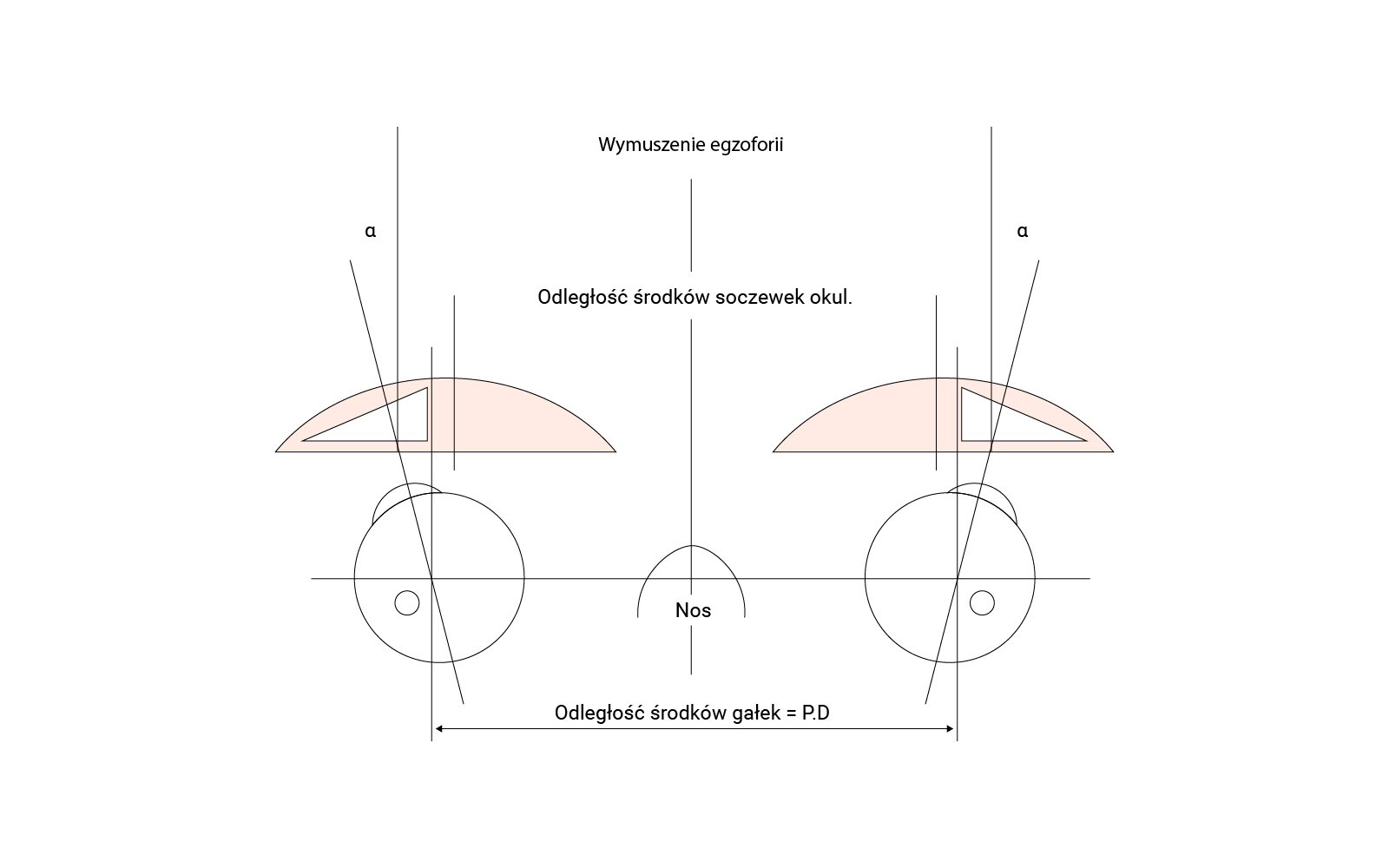 Grafika przedstawia wymuszenie zeza zbieżnego przez okulary z soczewkami dodatnimi o za małym rozstawieniu soczewek.