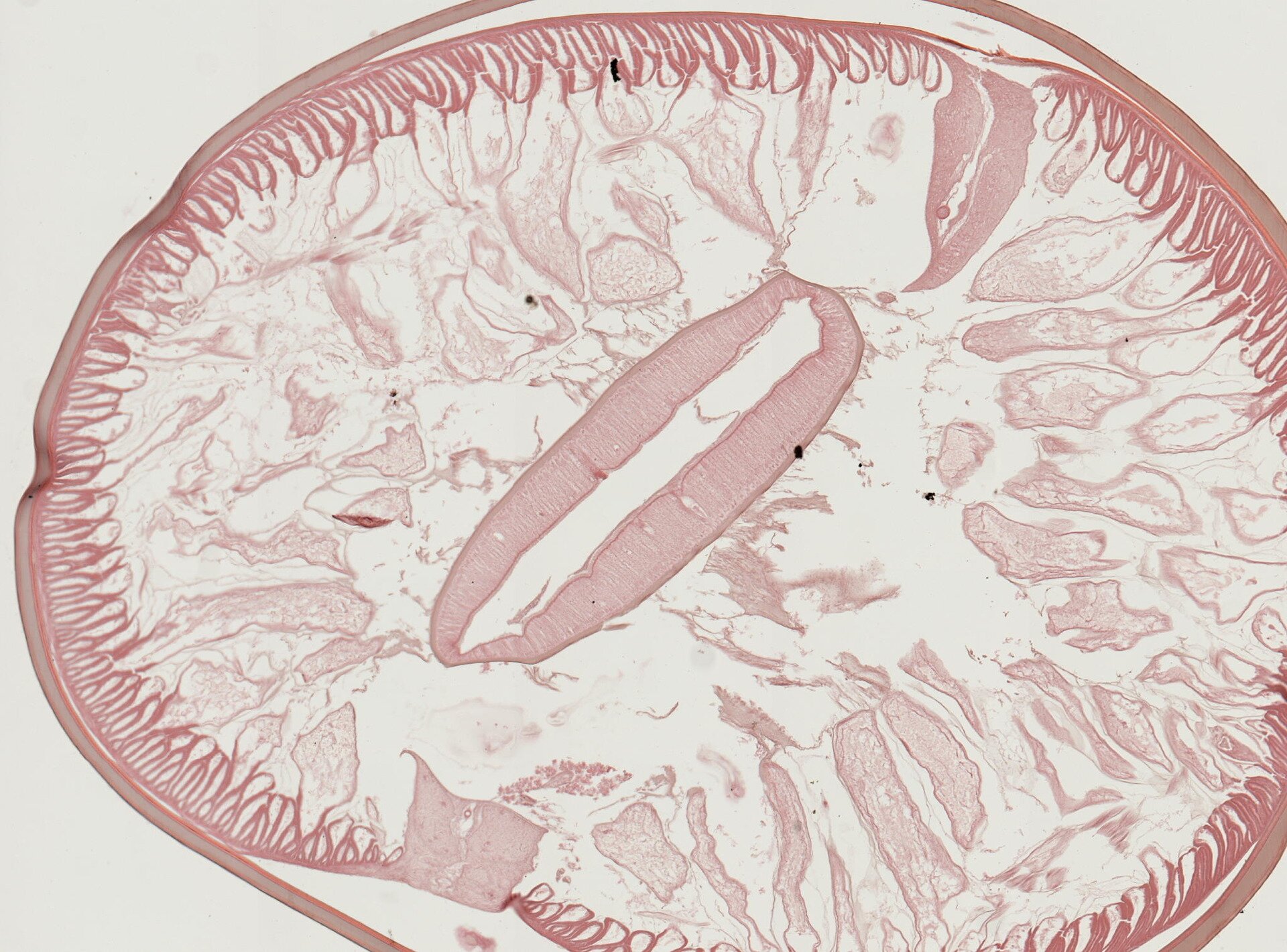 Zdjęcie przedstawia mikroskopowe powiększenie przekroju poprzecznego glisty ludzkiej. Przekrój jest owalny, jasnoróżowy. Po środku jest podłużny, wyróżniający się kształt, dalej mniejsze, jaśniejsze elementy. Zewnętrzna część jest ciemniejszego koloru.