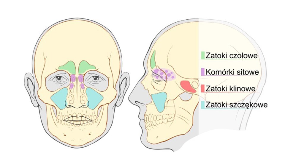 Ilustracja przedstawia rozmieszczenie zatok przynosowych. Po lewej i prawej stronie dolnej części nosa są zatoki szczękowe. Na schemacie mają trójkątny kształt. Nad oczami są zatoki czołowe. Z boku głowy w okolicach uszu są zatoki klinowe. Po bokach górnej części nosa są komórki sitowe. Mają postać drobnych jam.  