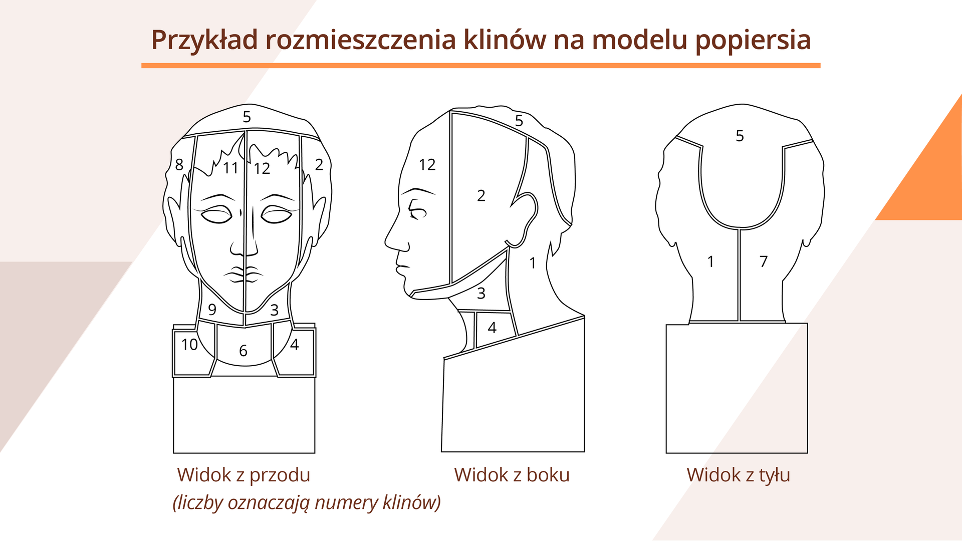 Grafika przedstawia przykłady rozmieszczenia klinów na modelu popiersia. Przedstawione zostały trzy widoki modelu ludzkiej głowy: z przodu, z boku oraz z tyłu. Popiersie jest podzielone na strefy oznaczone numerami, które odpowiadają miejscom rozmieszczenia klinów.