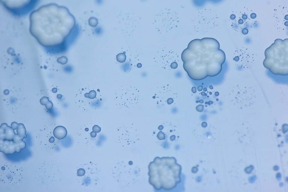 Mikroskopowe zdjęcie komórek drożdży. Kształtem przypominają popcorn.