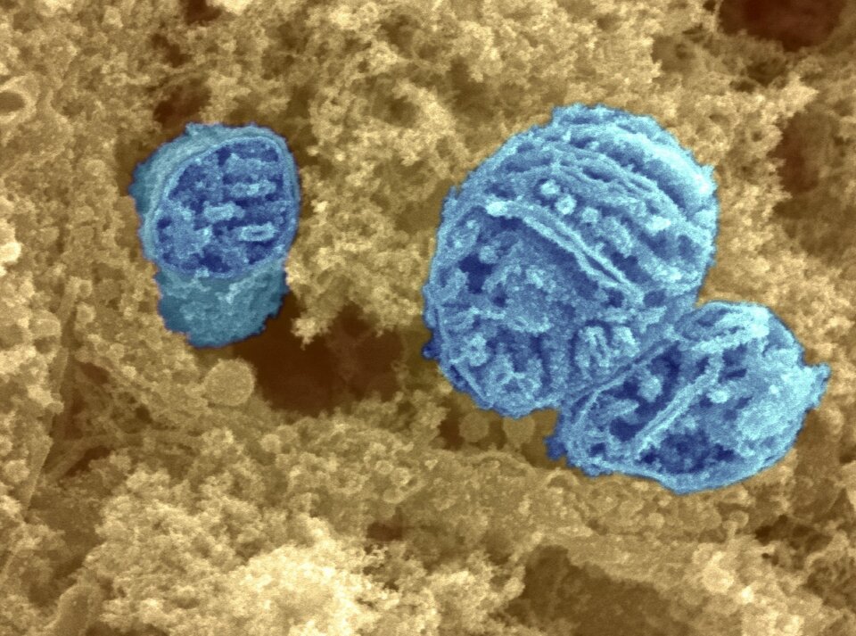 Ilustracja przedstawia mikroskopowe zdjęcie komórki z wyraźnie zaznaczonymi na niebiesko mitochondriami. Mają one kulisty kształt, ze względu na występujące w nich grzebienie mitochondrialne strukturą przypominają nieco kłębek włóczki. 