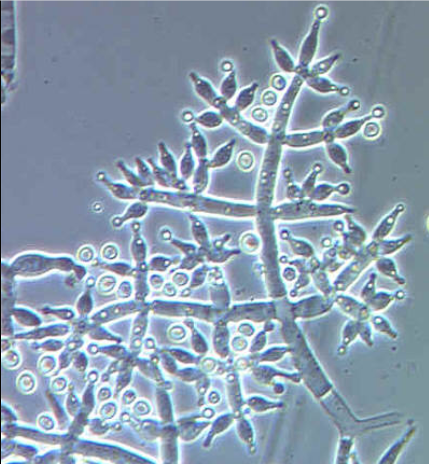 Zdjęcie przedstawia konidiofory grzyba Trichoderma harzianum w zbliżeniu mikroskopowym. Szczytowa strzępka grzybni, na której wytwarzane są zarodniki konidialne, jest rozgałęziona.
