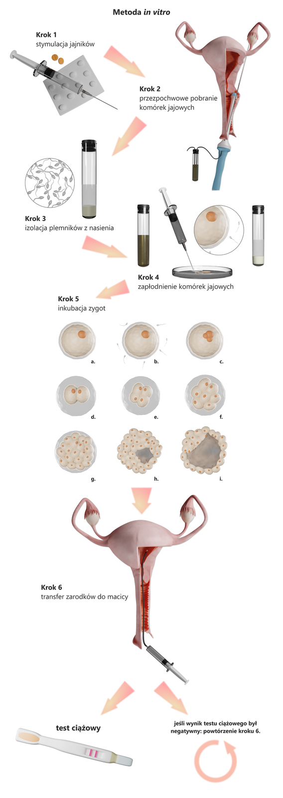Ilustracja przedstawia schemat postępowania przy metodzie in vitro. Krok pierwszy polega na stymulacji jajników za pomocą leków i zastrzyków hormonalnych. Krok drugi ukazuje macicę, z której przezpochwowo pobrane są komórki jajowe. Krok trzeci to izolacja plemników z nasienia (ukazana jest probówka z nasieniem i licznymi plemnikami). Krok czwarty ukazuje laboratoryjny proces zapłodnienia komórek jajowych. Do pobranych komórek jajowych wstrzykiwane są plemniki. Krok piąty ukazuje w dziewięciu etapach inkubacje zygot. Na ilustracji a widoczna jest duża, okrągła komórka jajowa z widocznym, okrągłym jądrem. Ilustracja b przedstawia tą komórkę otoczoną małymi plemnikami w owalnym kształcie z cienką, długą witką. Na obrazku c widać tą komórkę po zapłodnieniu – znajdujące się w niej jądro dzieli się. Na ilustracji d widać tą komórkę podzieloną na dwie mniejsze z żółtymi jądrami wewnątrz, na ilustracji e cztery przylegające do siebie komórki, na ilustracji f siedem takich komórek, a na ilustracji g dużą ilość takich niewielkich, owalnych komórek. Na ilustracji h widać powstającą na tle tych komórek blaszkę zarodkową, która na ilustracji i powiększa się. Krok szósty ukazuje macicę do której transferowane są zarodki. Następnie kobieta wykonuje test ciążowy. Jeśli jego wynik jest negatywny należy powtórzyć krok szósty, czyli transfer zarodków do macicy.