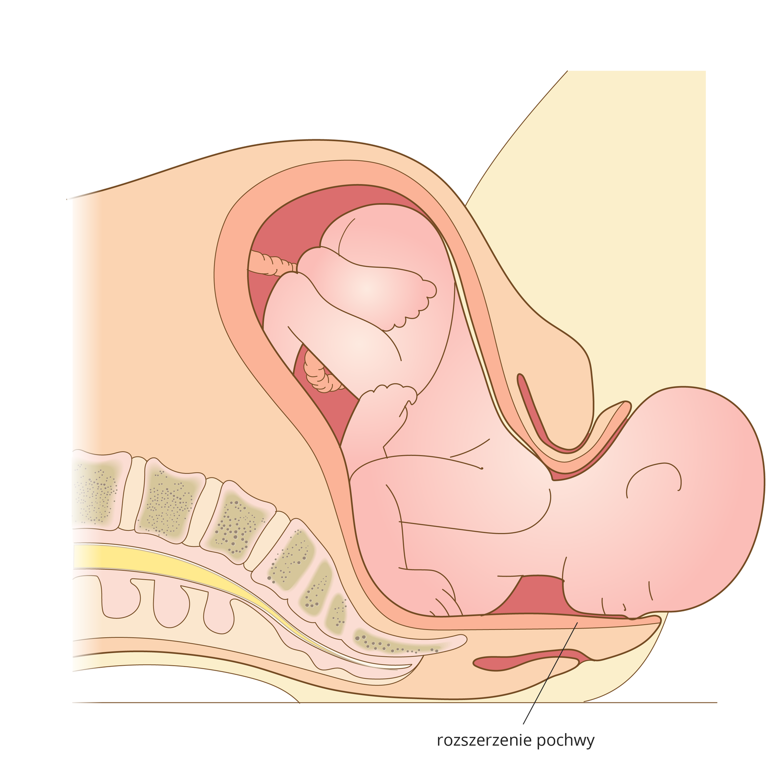 Ilustracja przedstawia kulminacyjny moment porodu. Dziecko jest wypychane przez rozszerzoną pochwę. Główka wychodzi na zewnątrz.