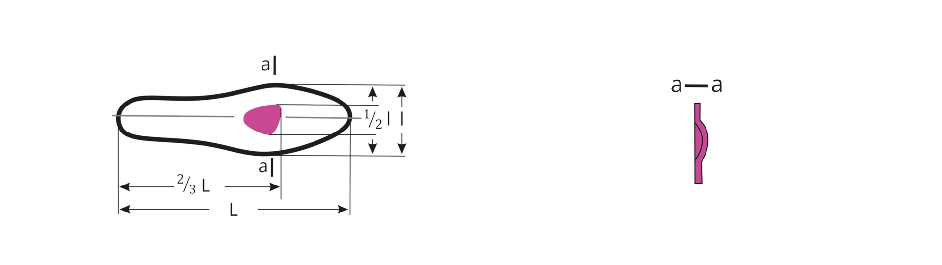 Grafika po lewej przedstawia kształt wkładki z zaznaczoną osią pionową i wkładkę ortopedyczną, znajdującą się w środkowej części śródstopia.
Grafika  po prawej przedstawia schemat przekroju wkładki z wkładką ortopedyczną, znajdującą się w środkowej części śródstopia.