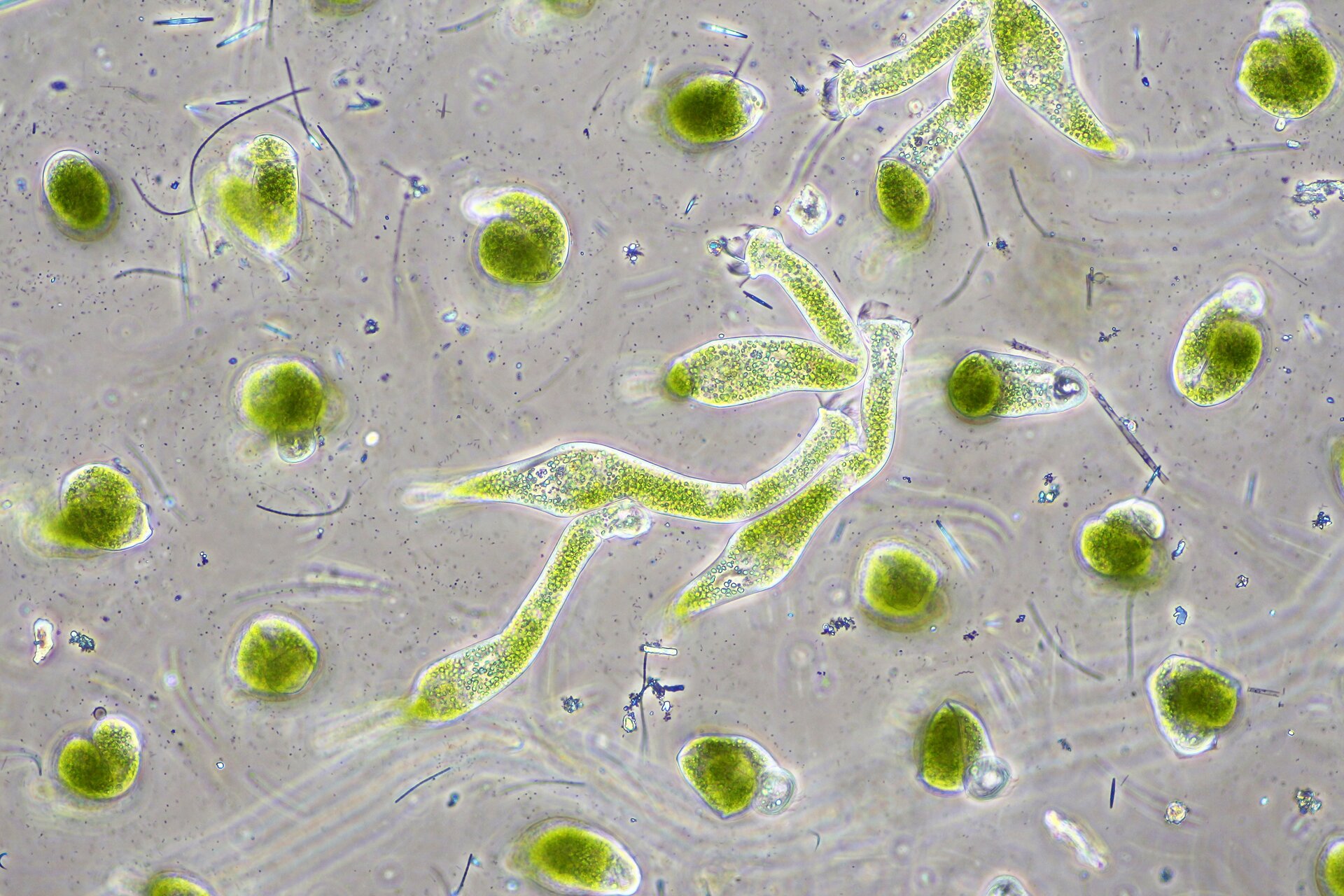 Zdjęcie przedstawia clorellę. Jest to glon jednokomórkowy o zielonej barwie i kulistym, lekko eliptycznym kształcie.