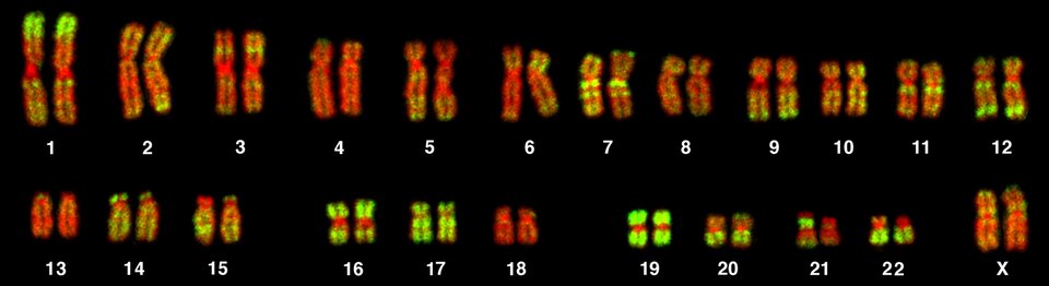 Na grafice przedstawiony jest zestaw chromosomów kobiety wyizolowany z limfocytu. Są to 23 pary chromosomów, chromosomy w poszczególnych parach mają podobny rozmiar i budowę. Dwudziesta trzecia para to dwa chromosomy X. Rozmiar chromosomów od pierwszej do dwudziestej drugiej pary stopniowo zmniejsza się.
