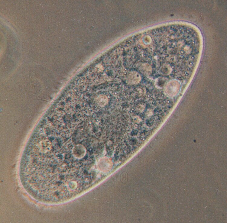 Fotografia spod mikroskopu przedstawia komórkę pantofelka. Wewnątrz widoczne są wodniczki – wyglądają jak bąbelki. Powierzchnia pantofelka pokryta jest rzęskami, które na fotografii są zamazane ze względu na ich szybki ruch.