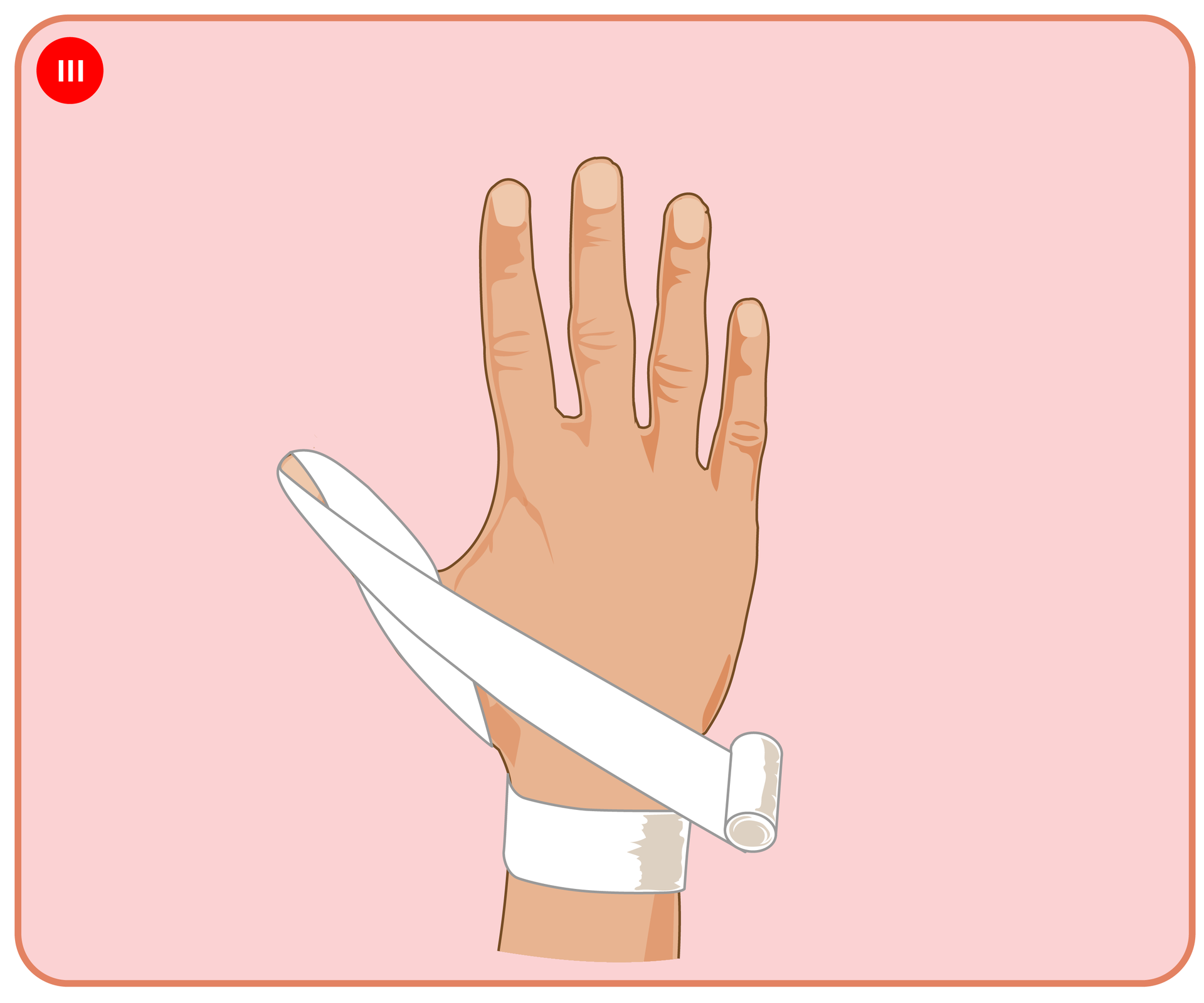 Pokaz slajdów prezentujących kolejne etapy bandażowania kciuka opatrunkiem kłosowym.