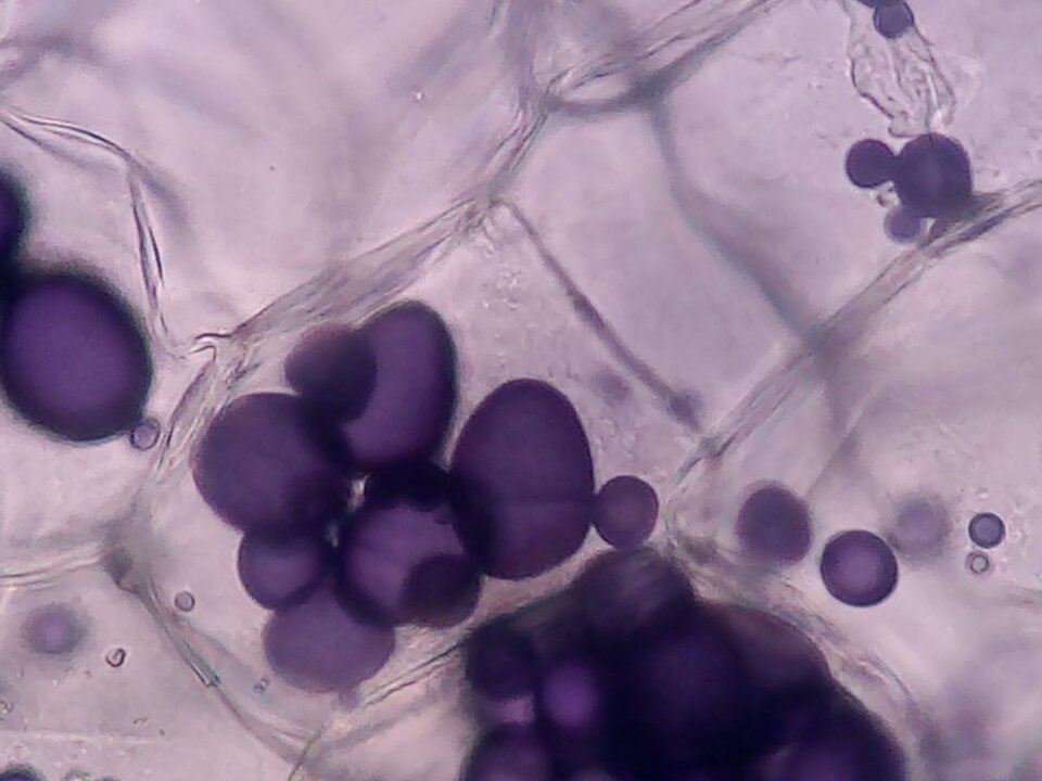 Zdjęcie mikroskopie przedstawia półprzezroczyste wielokąty, wewnątrz których widoczne są ciemnofioletowe, kuliste formy skrobi zapasowej. 