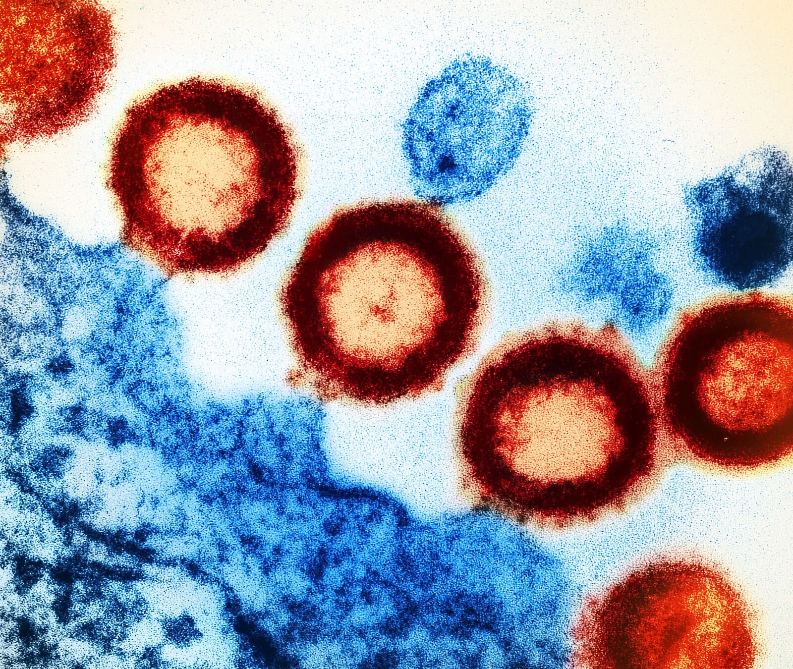 Fotografia przedstawia kilka czerwonych okręgów z ciemną obwódką i jasnym środkiem, które przyłączone są do niebieskiej błony komórkowej, o kształcie fali. Nad czerwonymi komórkami wirusa HIV widoczne są pojedyncze niebieskie okręgi.
