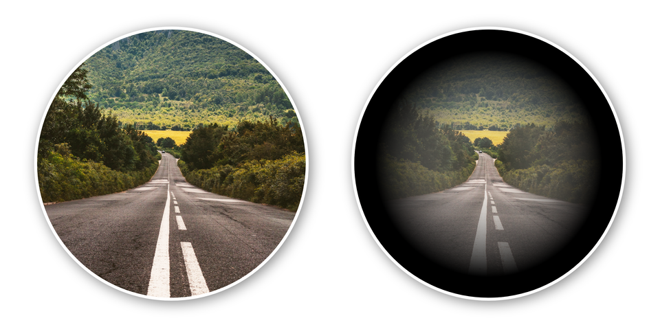 Ilustracja przedstawia dwa pola widzenia. Jedno osoby zdrowej, drugie chorującej na jaskrę. Widoczna jest droga. Po dwóch stronach rośnie las. U osoby chorej obrzeża zdjęcia są ciemne.