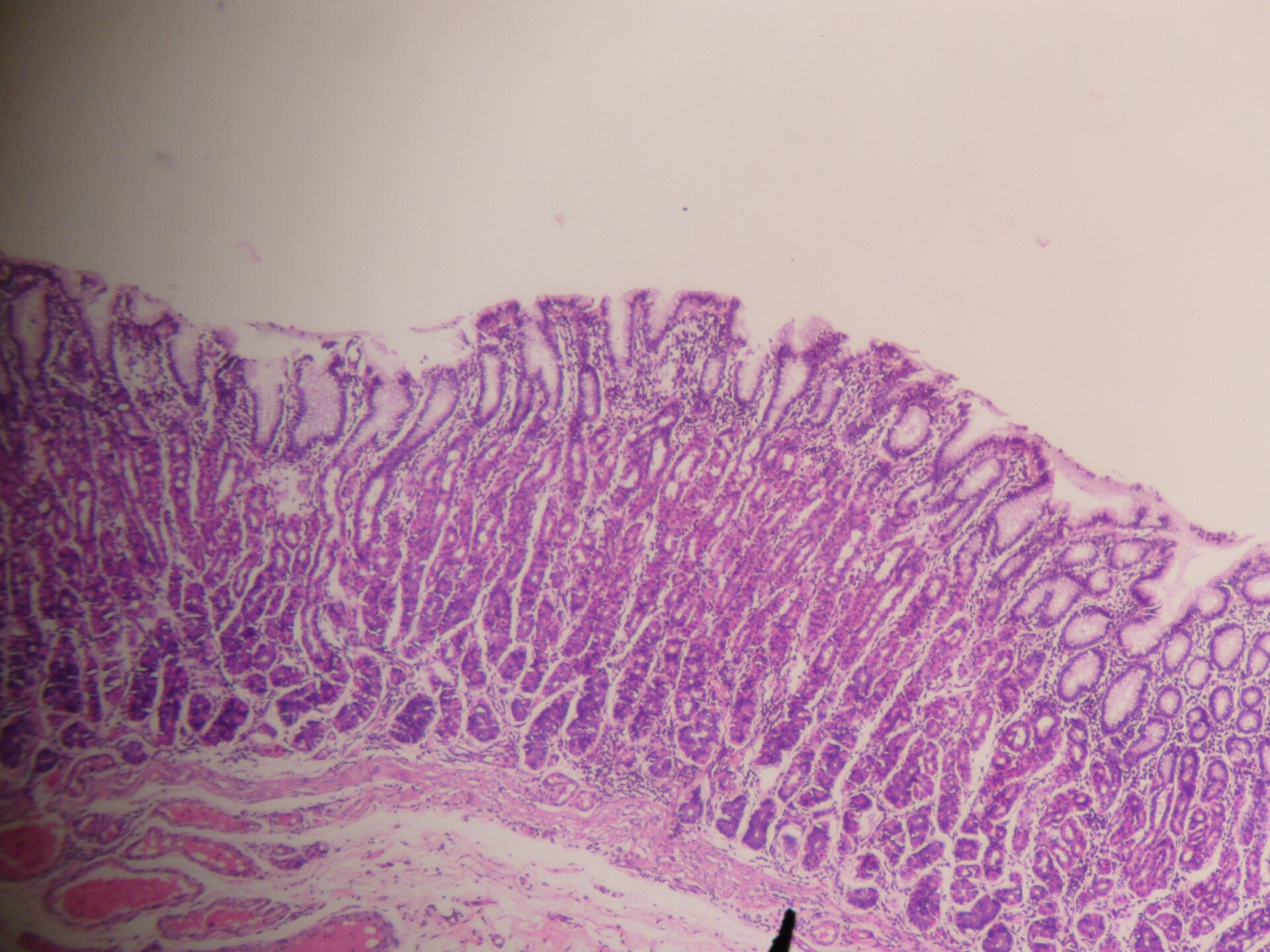 Zdjęcie mikroskopowe przedstawia ścianę żołądka. Obecne są cztery warstwy. Najbardziej wewnętrzna to pofałdowana błona śluzowa zabarwiona na kolor fioletowy, zbudowana z komórek walcowatych, z cewkowatymi gruczołami powstałymi przez wpuklanie się nabłonka. Pod nią znajduje się zabarwiona na fioletowo łącznotkankowa błona podśluzowa zbudowana z luźno ułożonych komórek z licznymi kanalikowymi przestrzeniami pomiędzy. Niżej znajduje się wybarwiona na różowo błona mięśniowa z komórkami ściśle do siebie przylegającymi, tworzącymi włókna mięśniowe. Pod nimi znajduje się błona surowicza zbudowana z cienkiej warstwy komórek, ściśle przylegająca do błony mięśniowej.