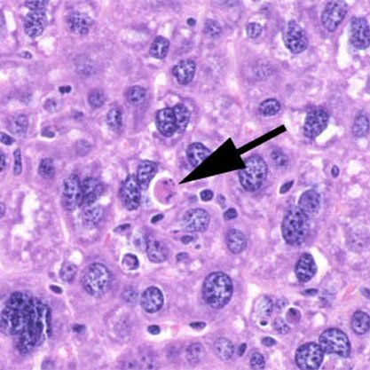 Zdjęcie przedstawia komórki mysiej wątroby. Widocznych jest dużo owalnych, sferycznych bądź nieregularnych kształtów komórek. Strzałką zaznaczono komórkę w fazie apoptozy.