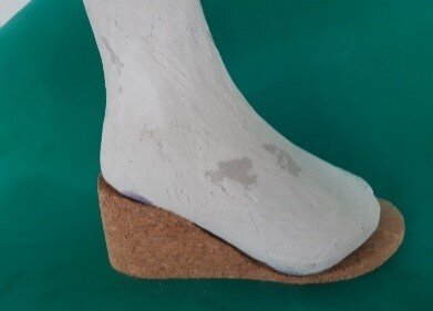 Zdjęcie przedstawia odlew gipsowy stopy, od zewnętrznej strony, dopasowany do wkładki z płyty suberytowej.