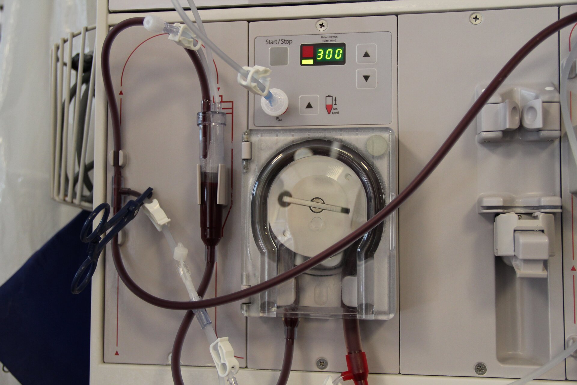Na zdjęciu pokazany jest aparat do dializy. Jest to jasnoszare urządzenie, które w górnej części posiada przyciski do sterowania oraz wyświetlacz. Poniżej znajdują się przeźroczyste przewody, w których płynie krew. 