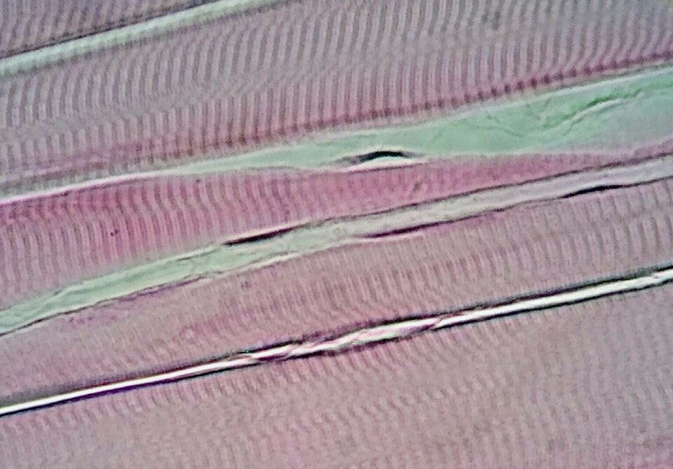 Na zdjęciu mikroskopowym widoczna jest tkanka mięśniowa. Widoczne są warstwy poprzecznie prążkowane. Ułożone są naprzemiennie, raz zielone, raz różowe. 