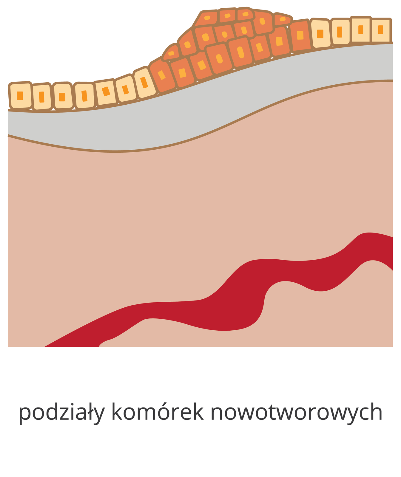 Ilustracja przedstawia mnożenie się komórek nabłonka. Widoczna jest warstwa komórek nabłonka. Leżą one obok siebie, w przekroju mają kształt prostokąta. Wewnątrz widać koliste jądro. W pewnym miejscu komórki nabłonka mają inny kolor. Posiadają one zmianę nowotworową. Komórki dzielą się, tworząc wypukłą na zewnątrz zmianę, składającą się z trzech warstw komórek nowotworowych. Pod spodem widać dwie warstwy innych komórek. Jest ona narysowana schematycznie, nie widać poszczególnych komórek. W głębi drugiej warstwy widać czerwone naczynie krwionośne. Pod obrazkiem widać napis: podziały komórek nowotworowych.
