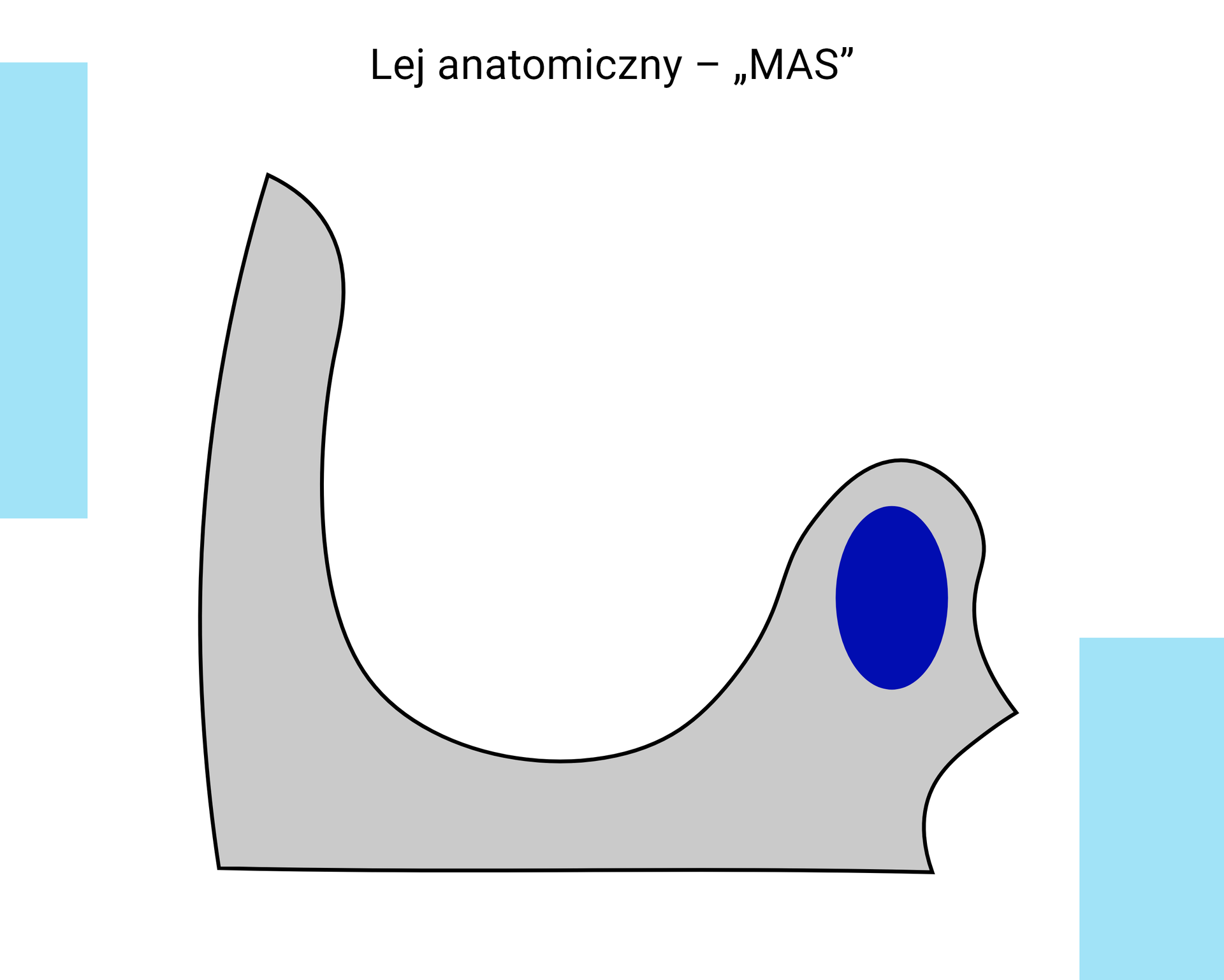 Schemat graficzny przedstawiający przekrój czołowy kształtu wejścia leja z umiejscowieniem guza kulszowego.