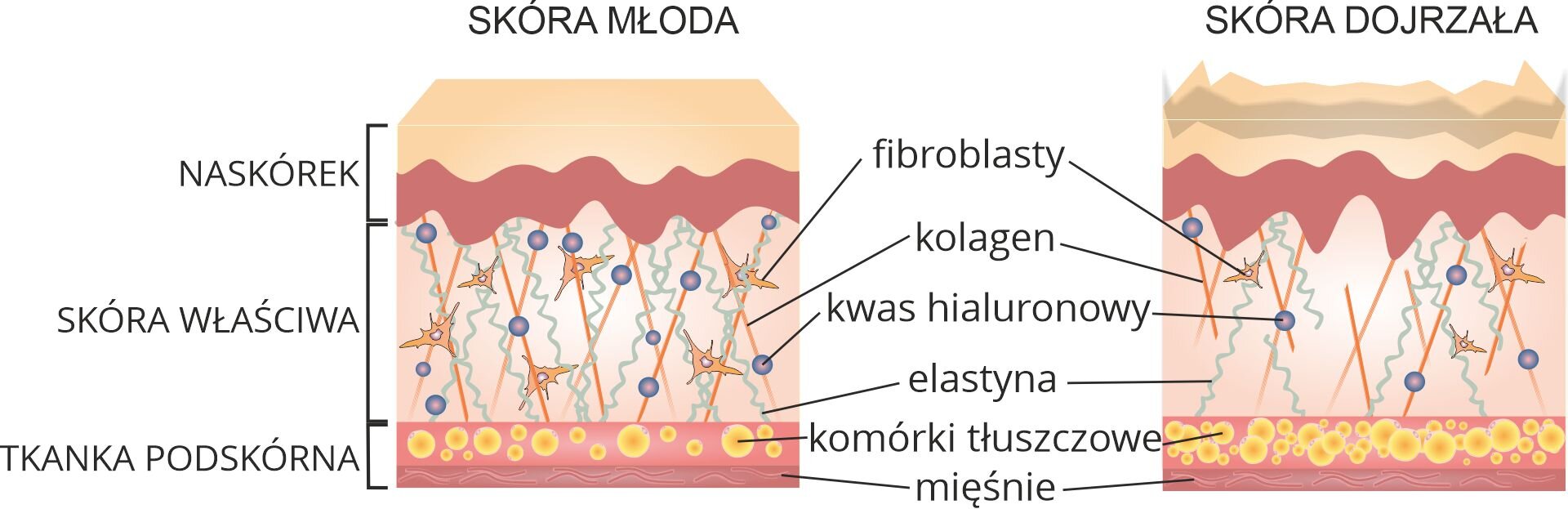 Grafika przedstawia różnice w budowie skóry młodej i dojrzałej. W przypadku skóry młodej naskórek jest regularny i gładki, podczas gdy naskórek skóry dojrzałej jest nieregularny i pofałdowany. W skórze właściwej skóry młodej znajdują się liczne różnokształtne fibroblasty, podłużne włókna kolagenu, cząsteczki kwasu hialuronowego oraz poskręcane włókna elastyny. W przypadku skóry dojrzałej struktury znajdujące się w skórze właściwej są dużo mniej liczne. W tkance podskórnej znajdują się komórki tłuszczowe i mięśnie. W skórze młodej występuje znacznie mniej komórek tłuszczowych niż w skórze dojrzałej.