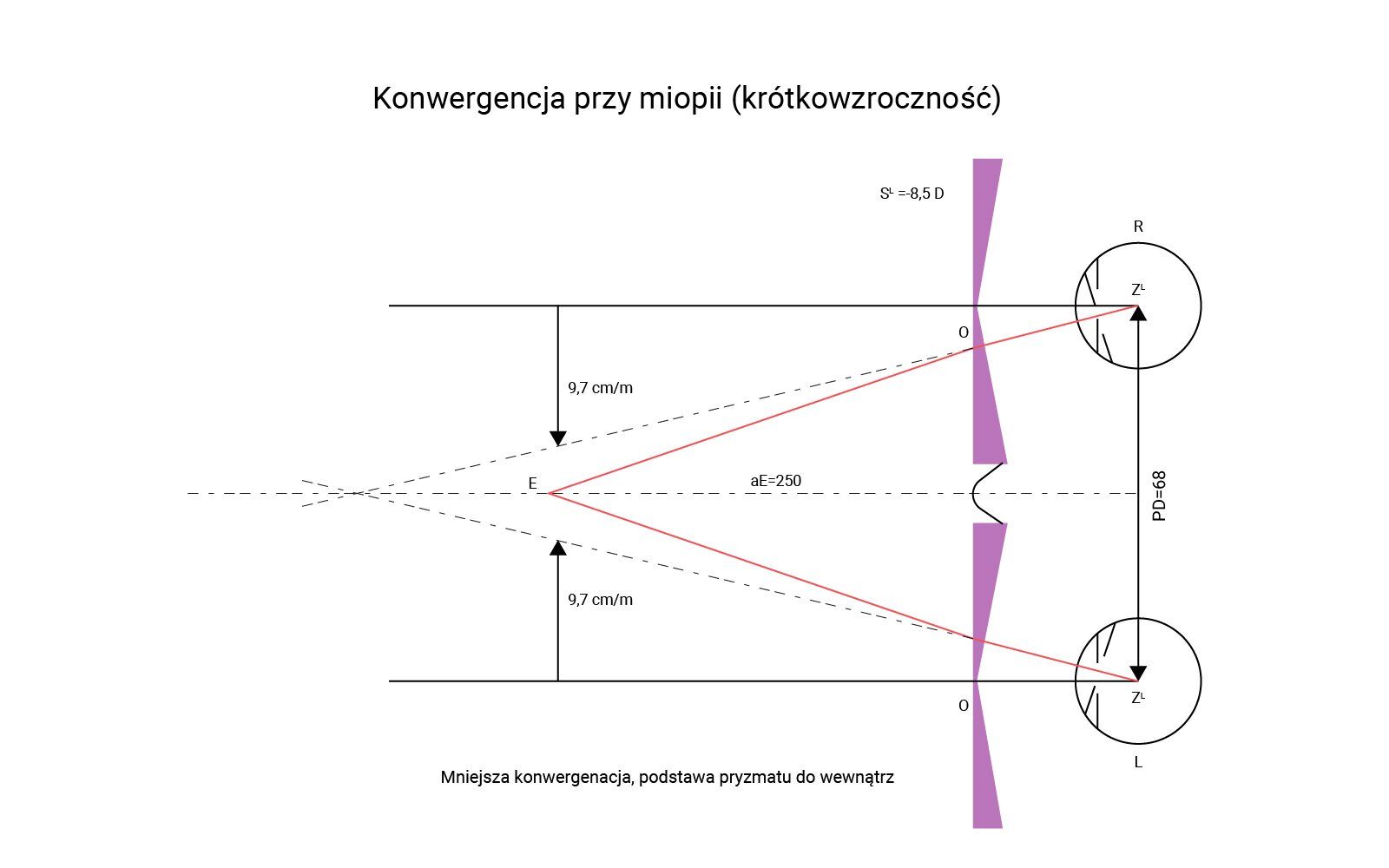 Na grafice przedstawiona konwergencja przy miopii (krótkowzroczność).