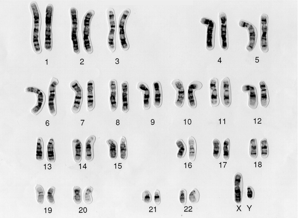 Ilustracja interaktywna przedstawia kariotyp mężczyzny. Na ilustracji są 22 pary chromosomów, ostatnia para jest oznaczona dużą literą X i dużą literą Y. Chromosom X jest dłuższy od chromosomu Y. Początkowo chromosomy są większe, następnie mniejsze. W chromosomach widoczne są paski w różnych odcieniach szarości. Chromatydy w danej parze chromosomów mają stosunkowo równą długość.