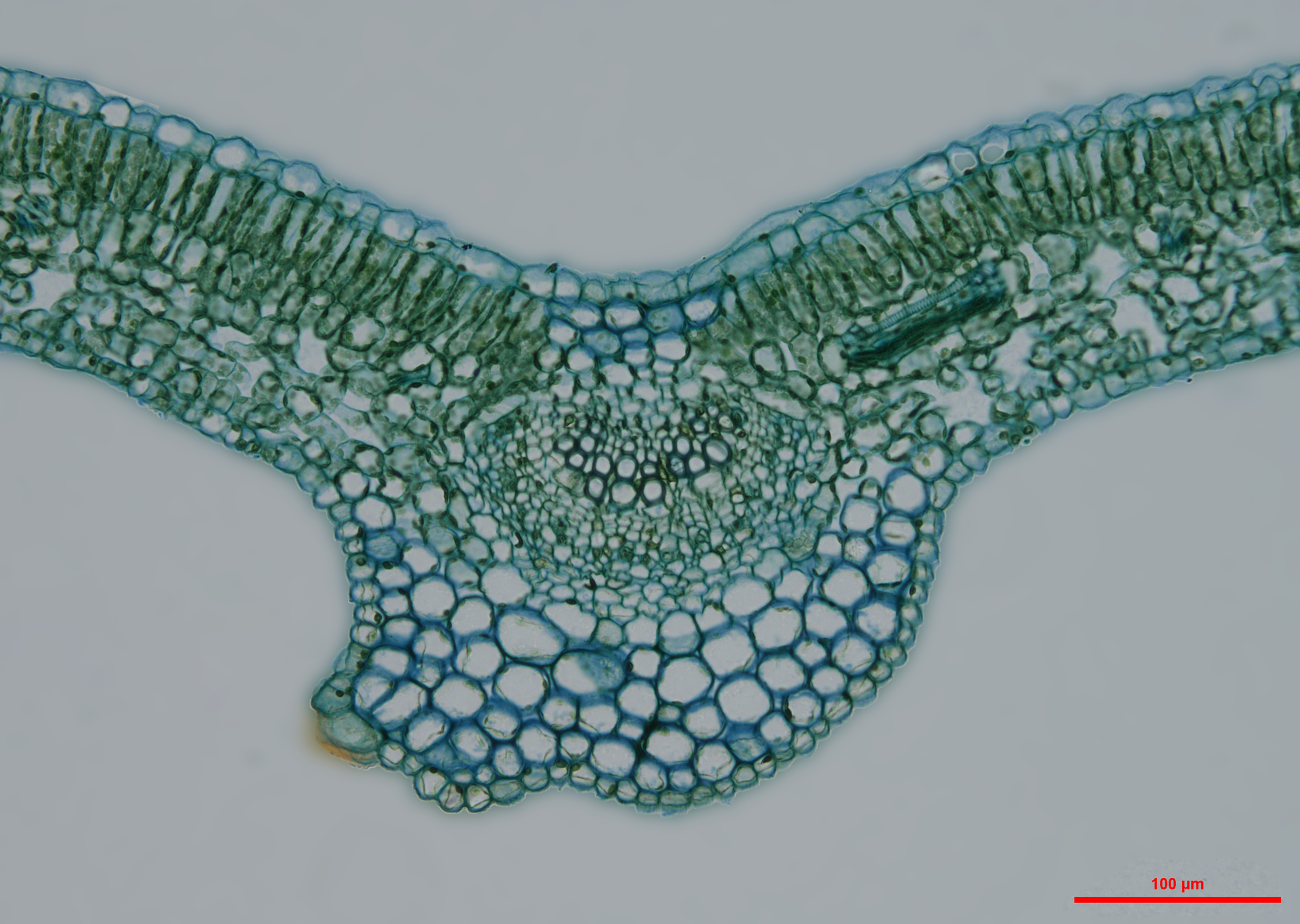 Zdjęcie spod mikroskopu przedstawia bardzo mały fragment liścia, w którym widoczne są komórki. Komórki mają różne kształty. W pobliżu ścian komórkowych gromadzi się najwięcej ciemnozielonych chloroplastów, dlatego komórki mają grube zielone obrysy. W niektórych komórkach na zielono, ale mniej intensywnie, jest również zabarwione ich wnętrze.