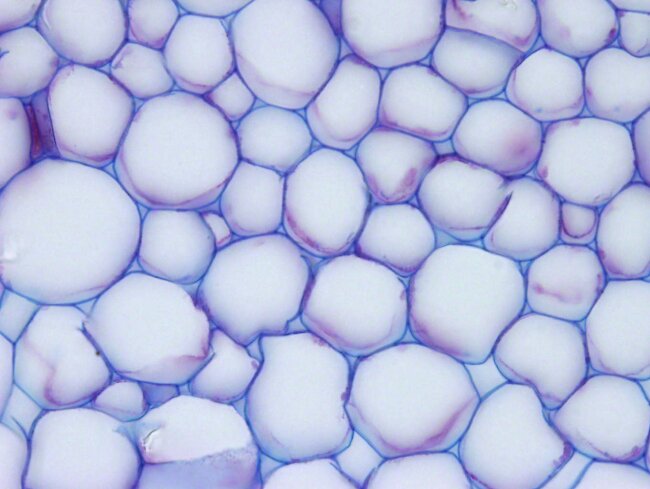 Na fotografii spod mikroskopu świetlnego w powiększeniu czterystukrotnym widoczne są komórki roślinne łodygi kaktura z dużymi wakuolami, w których magazynowana jest woda. Mają postać przylegających do siebie, okrągłych struktur otoczonych niebieską ścianą komórkową. 