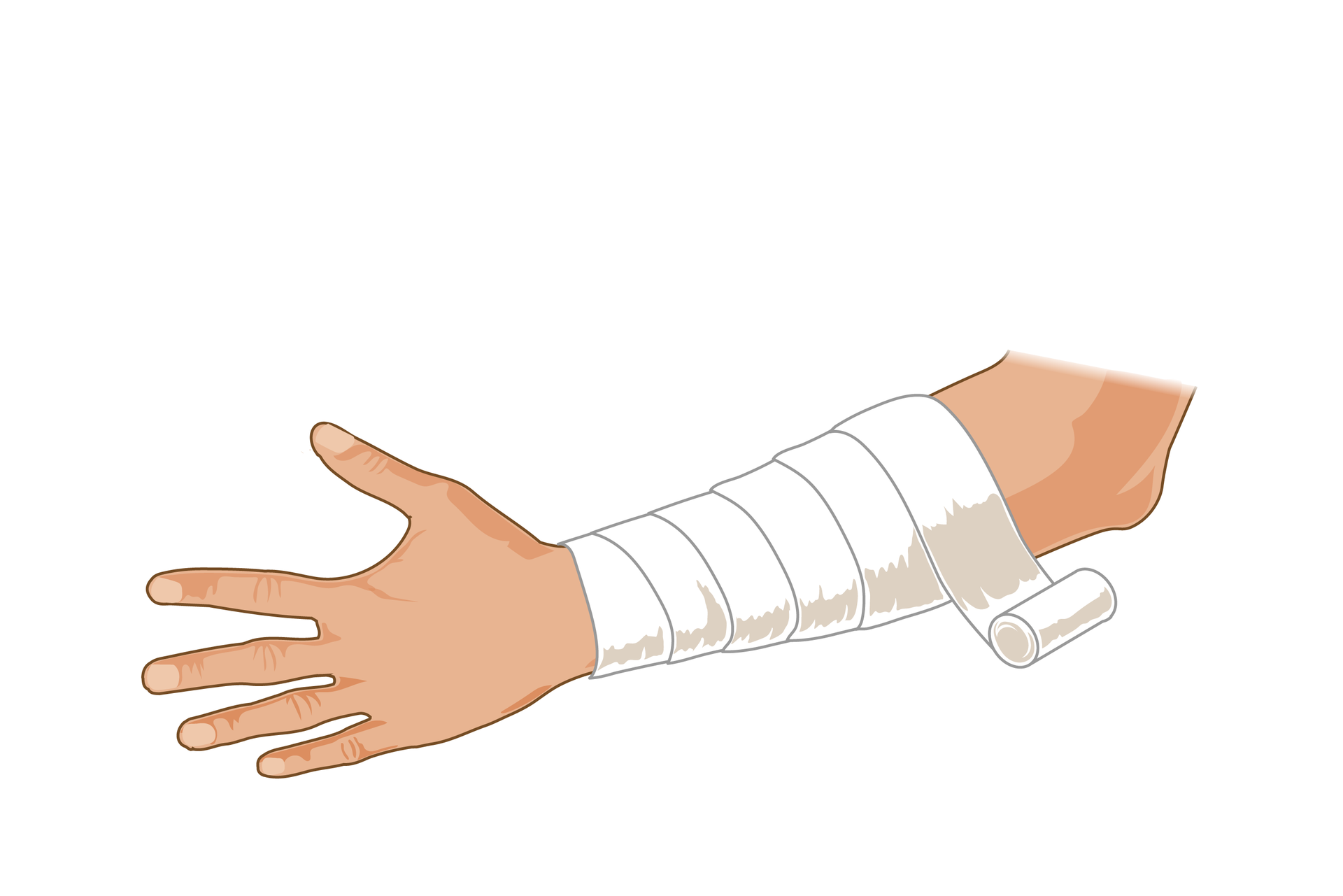 Ilustracja przedstawia zabezpieczanie rany. Lewa ręka ukazana od dłoni z wyprostowanymi palcami po lewej stronie rysunku do łokcia po prawej stronie skierowana jest zewnętrzną stroną do obserwatora. Całe przedramię, od nadgarstka do łokcia jest owinięte białym bandażem. Bandaż nawinięty spiralnie od nadgarstka kończy się w okolicy łokcia rolką.