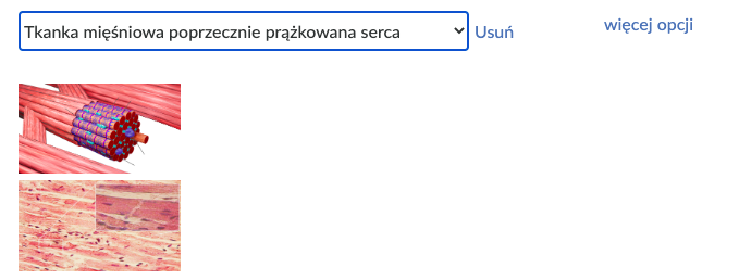 Zdjęcie przedstawia widok po wyborze kategorii. Na górze znajduje się pasek wyszukiwarki. Została wybrana tkanka mięśniowa poprzecznie prążkowana serca. Pod spodem widoczne są dwa zdjęcia przedstawiające tkanki.