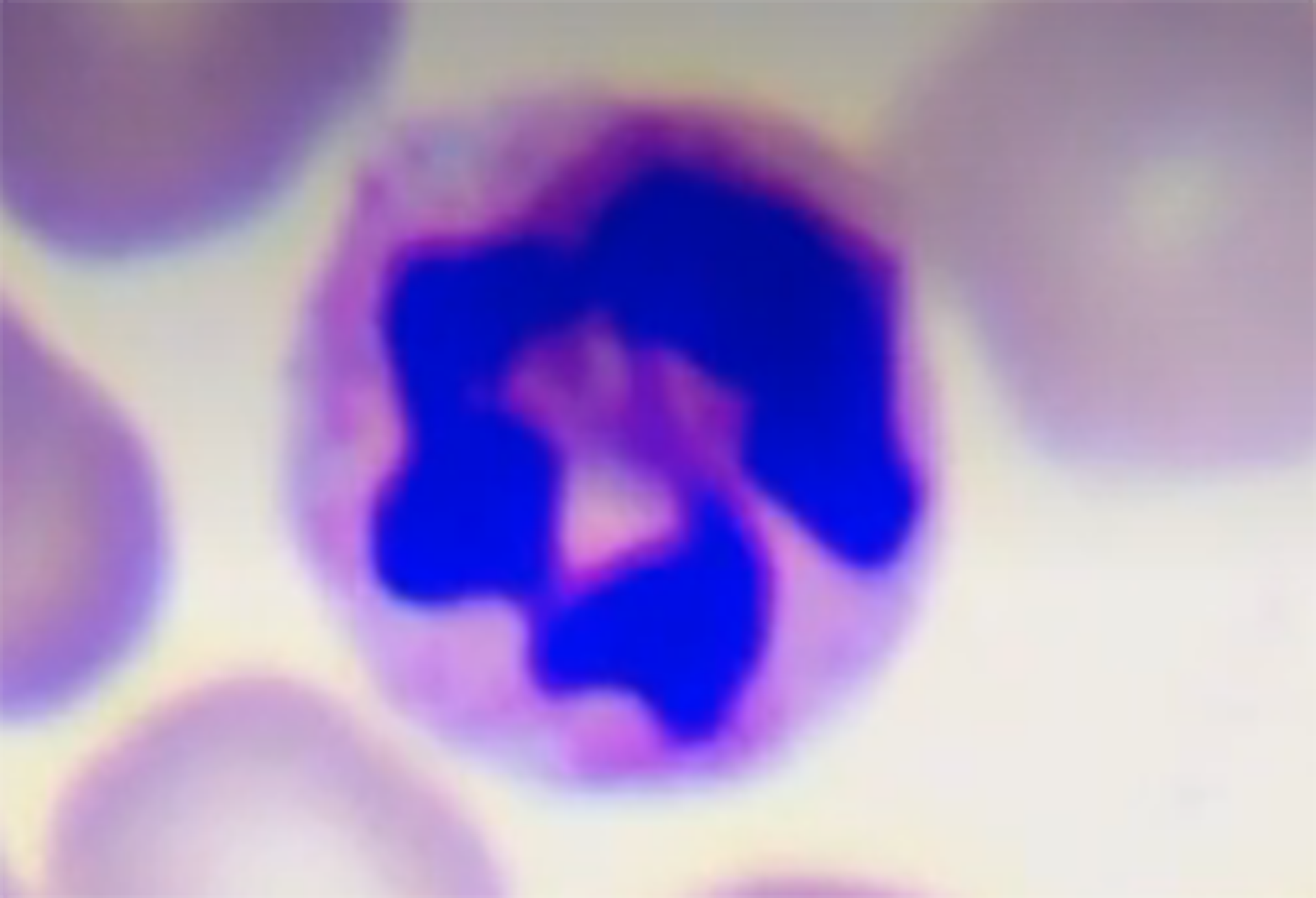 Na ilustracji jest obraz mikroskopowy w powiększeniu całkowitym: 1000 razy. Pokazano okrągłą strukturę o różowym zabarwieniu. W środku w postaci pierścienia jest niebieskie zabarwienie. Dookoła są okrągłe jasnoróżowe struktury z białawym środkiem.