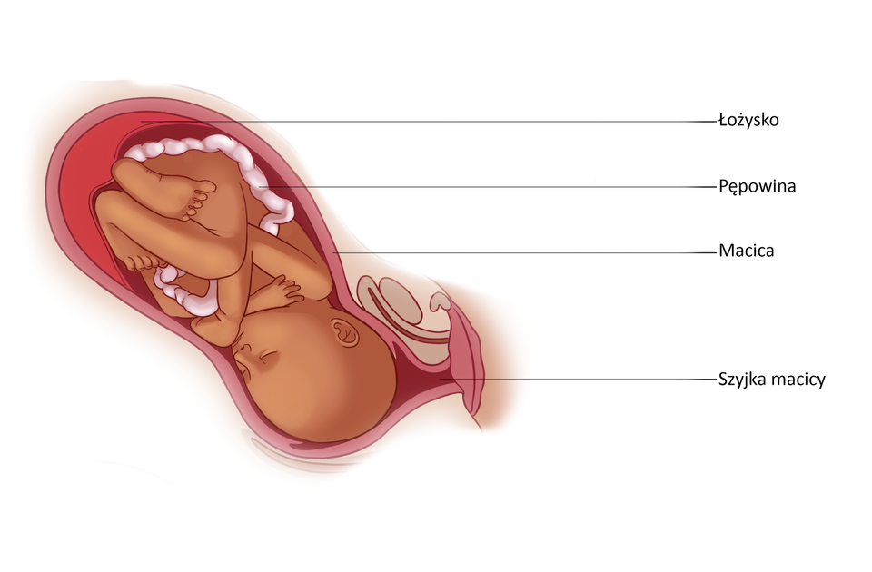 Ilustracja przedstawia ułożenie dziecka głową w dół w macicy. Macica jest wydłużona, owalna, w jej górnej części znajduje się łożysko (ponieważ dziecko jest ułożone głową w dół, więc dotyka łożyska stopami). Płód z łożyskiem łączy pępowina. Wylot z macicy to szyjka macicy. Dziecko ma w jej pobliżu głowę.   
