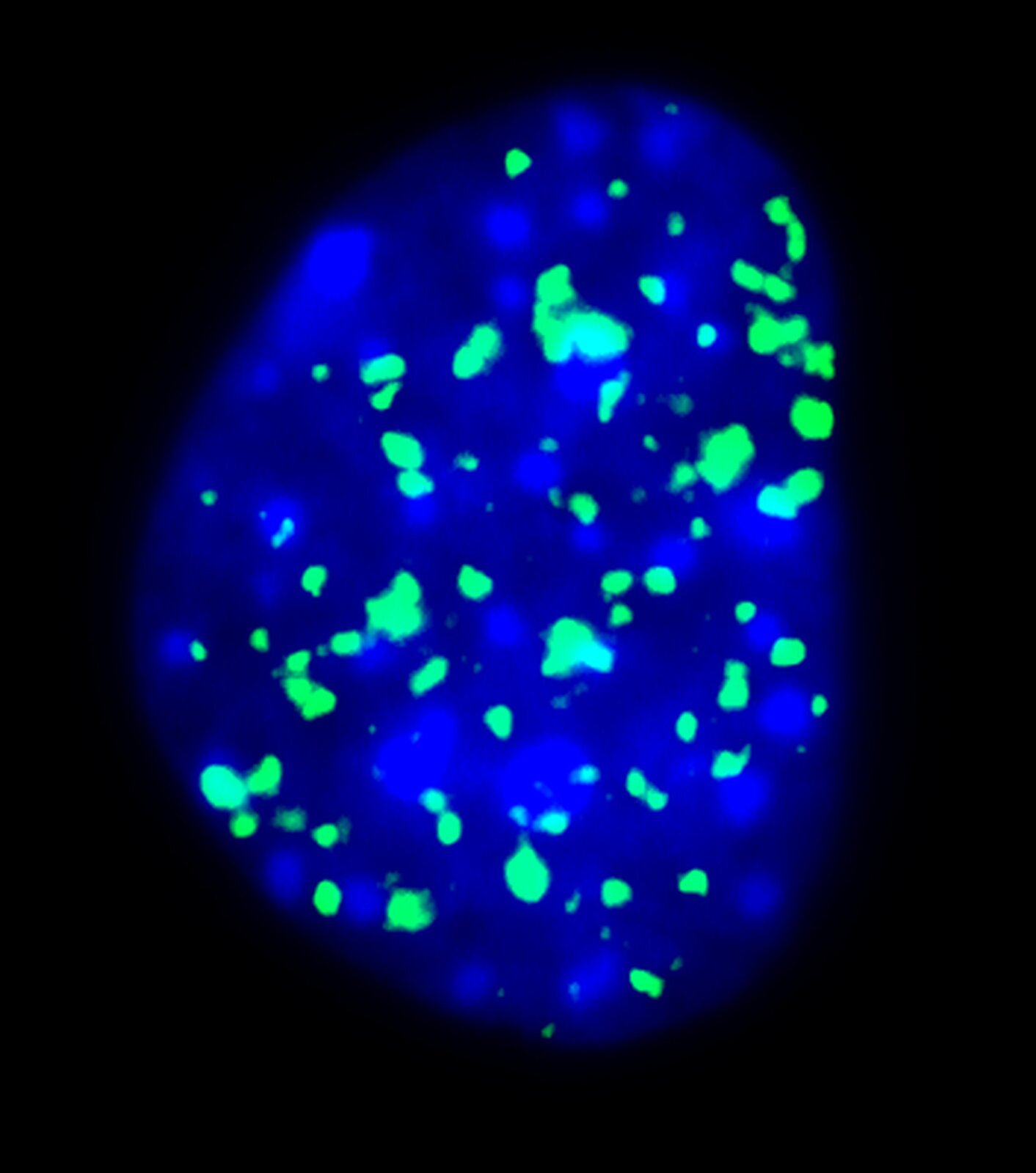 Rys. 8b. Zdjęcie przedstawia obraz białek fluorescencyjnych w postaci niebieskiego żelu z widocznymi zmianami o barwie zielonej. Całość na czarnym tle.