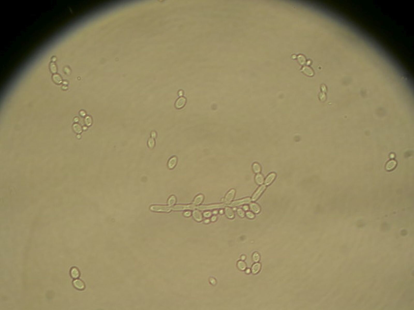 Fotografia przedstawia obraz mikroskopowy bielnika białego. Na czarnym tle znajduje się żółty półokrąg, na którym widoczne są, połączone ze sobą, owale i okręgi.