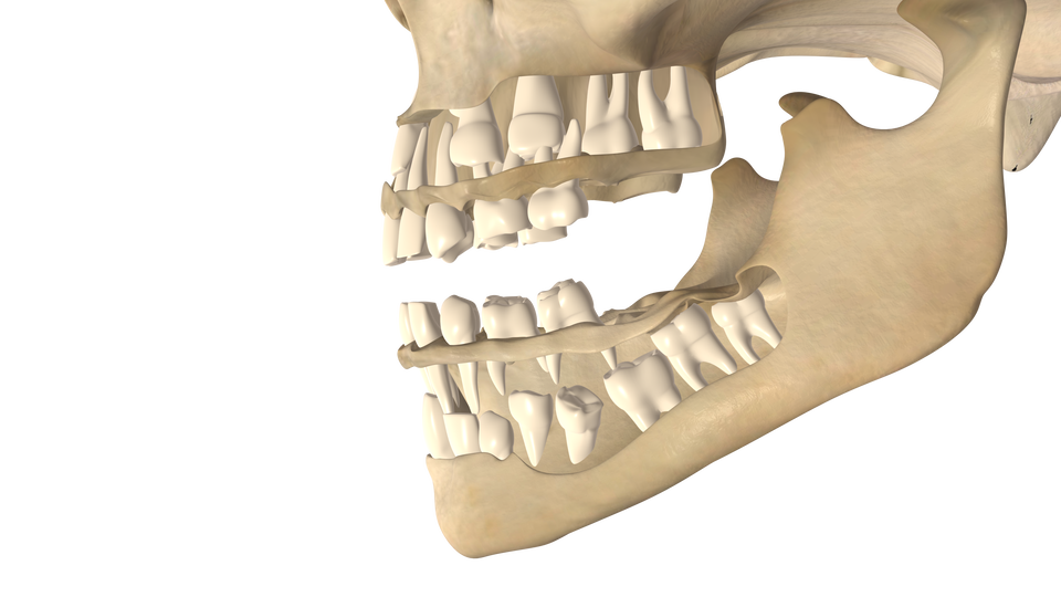 Zdjęcie przedstawia szczękę dziecka. Widoczne są dwa zestawy zębów w kości żuchwy. W pierwszej warstwie są to zęby mleczne, jest ich mniej niże przyszłych zębów stałych, które dopiero wyrosną. W warstwie zębów mlecznych przedstawiono zęby od 1 do 4. W drugim rzędzie, poniżej warstwy zębów mlecznych, widoczne są przyszłe zęby stałe. Jest ich więcej. W warstwie zębów stałych przedstawiono zęby od 1 do 7.