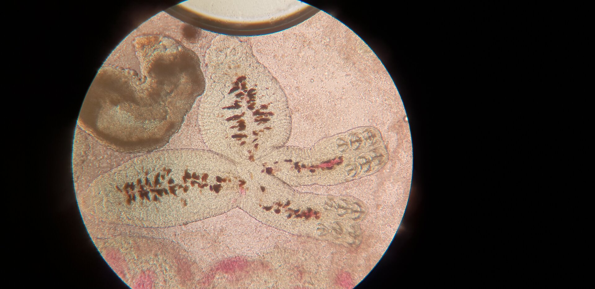Zdjęcie spod mikroskopu przedstawia przywry diplozoon. Dwie przywry są ze sobą złączone środkową częścią ciała. Kształtem przypominają literę X. Ciało przywr jest głównie przezroczyste.