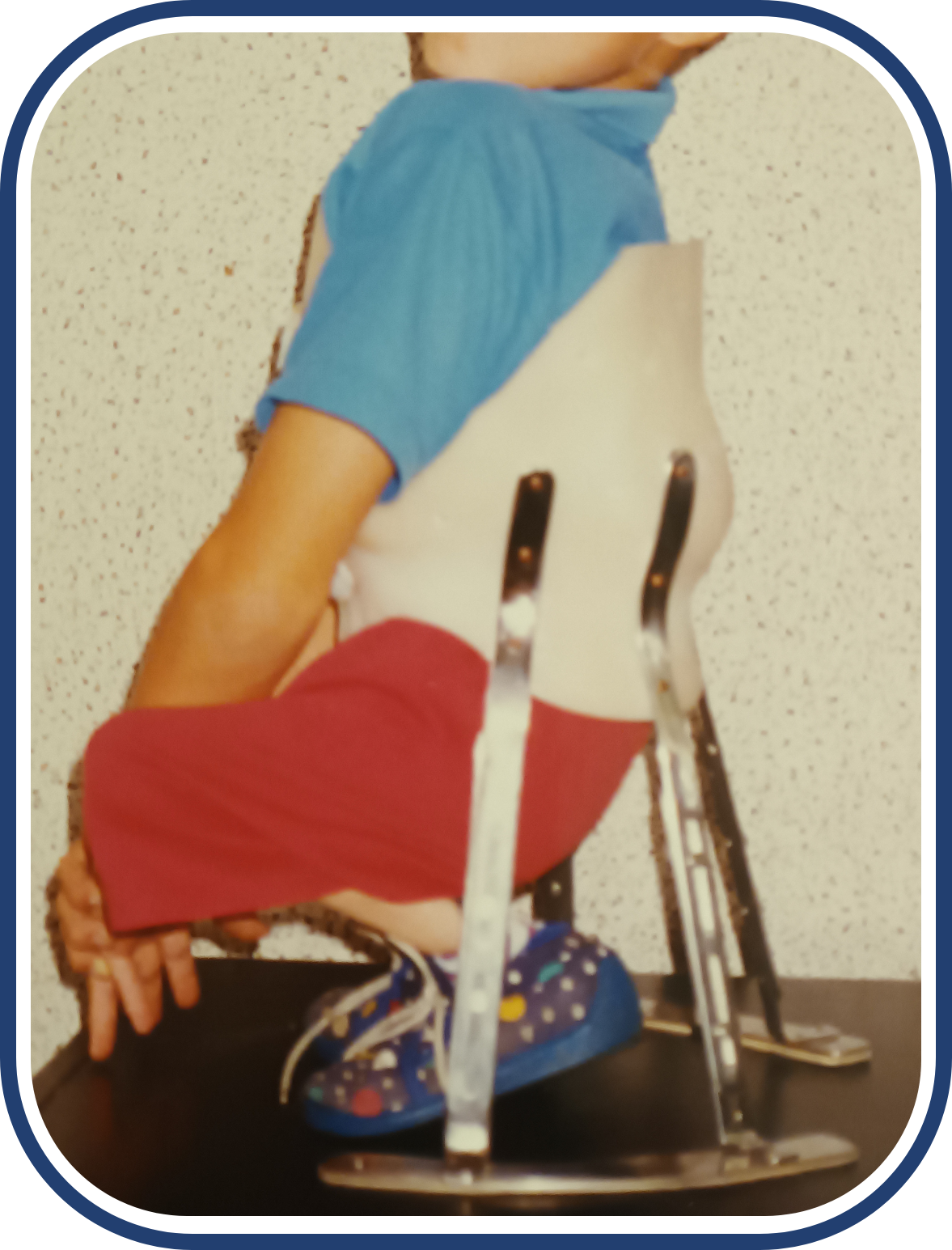 Zdjęcie przedstawia dziecko w gorsecie sięgającym od miednicy do łopatek. Do gorsetu przymocowane są cztery pionowe szyny, po dwie z prawej i lewej strony. Szyny zakończone są płaskimi poziomymi podstawami umożliwiającymi użytkownikowi siedzenie. 