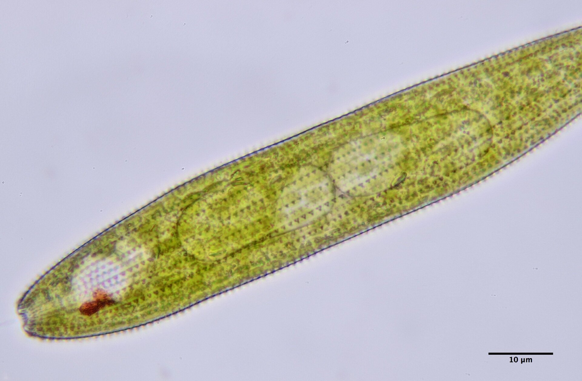Na zdjęciu mikroskopowym widoczna jest euglena zielona. Ma wrzecionowaty kształt. W chloroplastach znajduje się chlorofil. Z przodu jej ciała znajduje się czerwona plamka oczna.