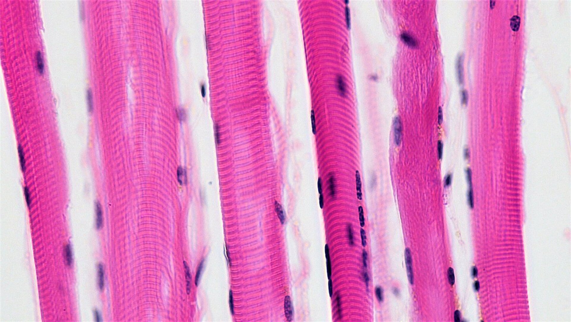 Na zdjęciu mikroskopowym widoczne są podłużne struktury w kolorze różowym. Są one warstwą równolegle, naprzemiennie ułożonych komórek. Są poprzecznie prążkowane. Znajdują się na nich wąskie, małe formy koloru fioletowego. 