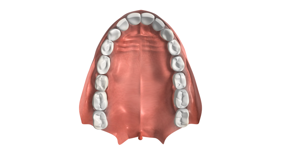 Zdjęcie przedstawia górny łuk zębowy. Każda połowa łuku zawiera po 8 zębów człowieka. Widoczne jest podniebienie. 
