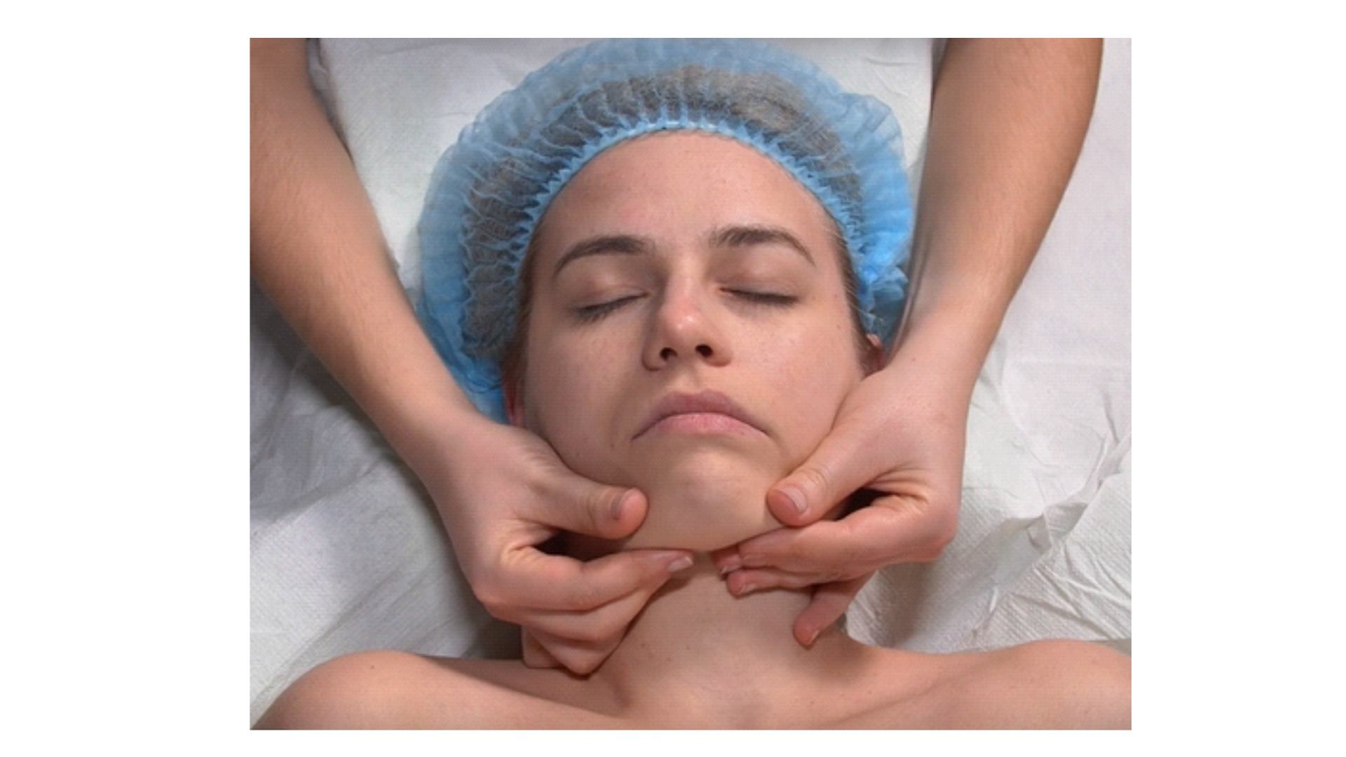 Zdjęcie przedstawia twarz pacjenta w leżeniu tyłem. Głowa pacjenta spoczywa na poduszce. Masażysta znajduje się za głową pacjenta i wykonuje ruch chwytem szczypcowym, kciukiem i palcem wskazującym obu rąk, kierując się od brody do końca żuchwy.