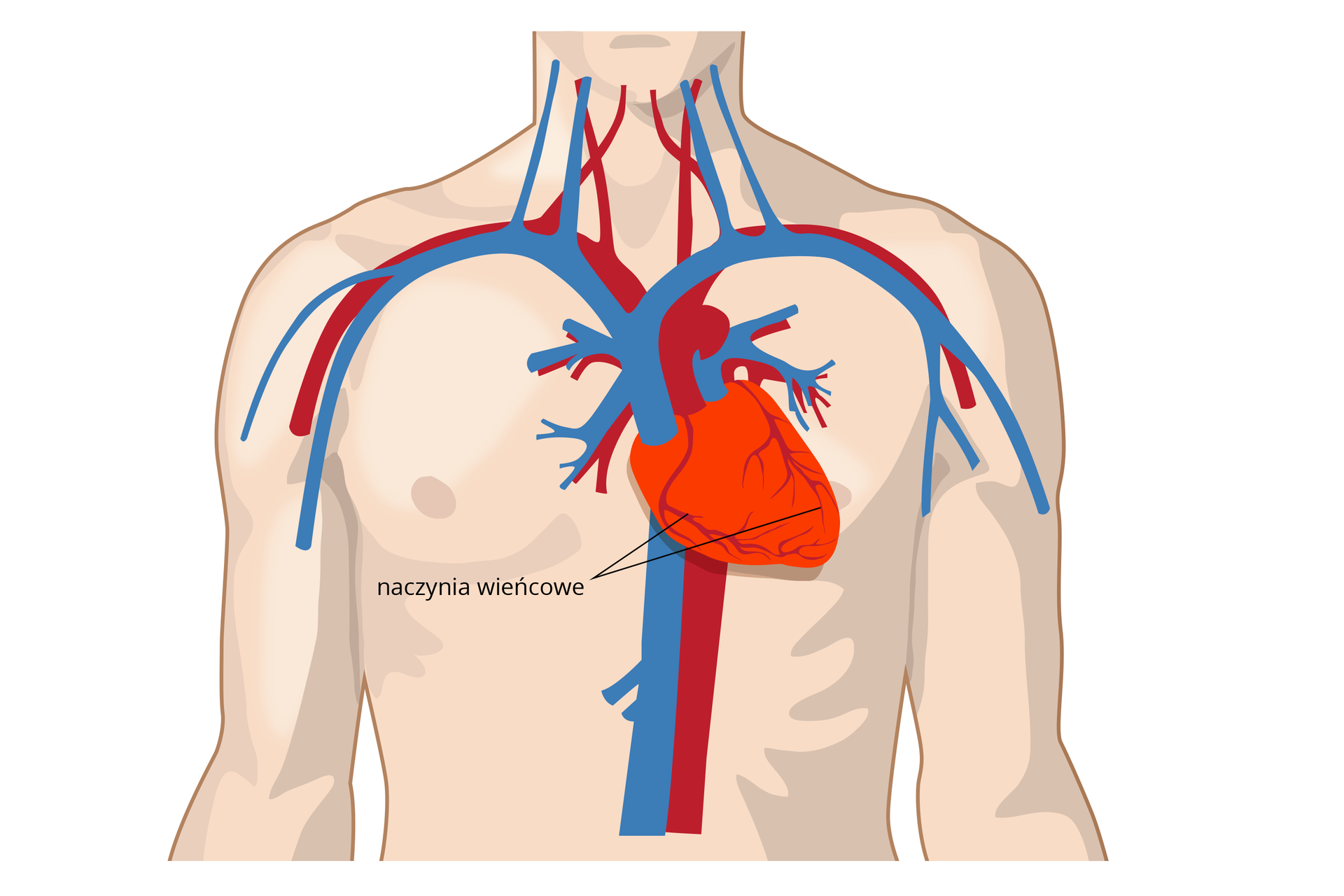 Ilustracja przedstawia różową sylwetkę torsu człowieka. Wrysowano w nim na środku klatki piersiowej jaskrawo czerwone serce. Koniuszek serca skierowany w bok. Na sercu szare rozgałęzienia, czyli naczynia wieńcowe. U góry i za sercem grube naczynia krwionośne: niebieskie żyły, czerwone tętnice.
