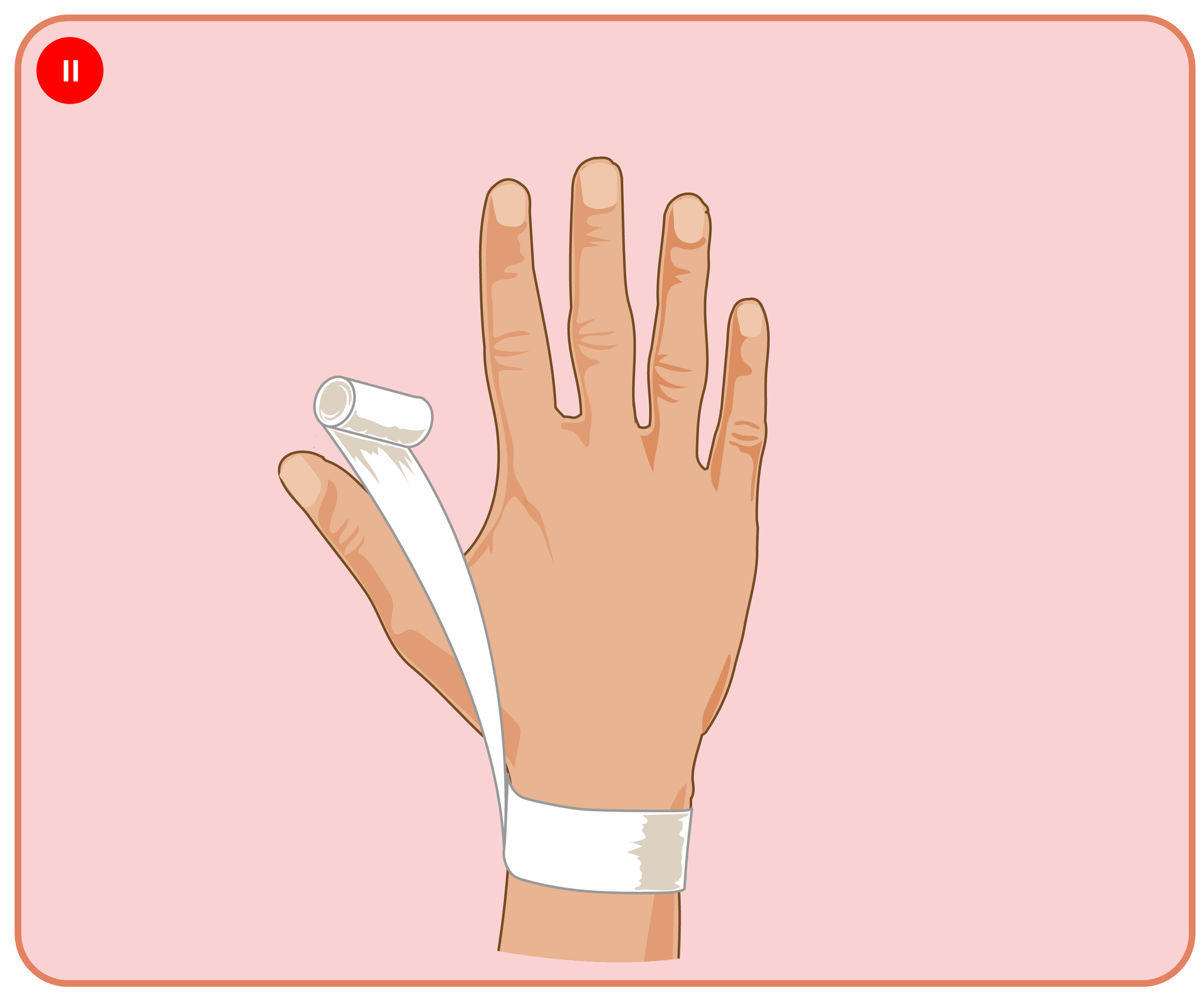 Fotografia przedstawia owinięty bandażem nadgarstek i kciuk